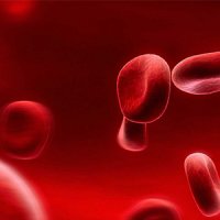انواع و علائم کم خونی را می شناسید؟